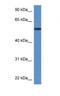 Phosphoglucomutase 5 antibody, NBP1-74091, Novus Biologicals, Western Blot image 