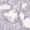 Msh Homeobox 1 antibody, NBP2-57969, Novus Biologicals, Immunohistochemistry paraffin image 