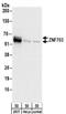 Zinc Finger Protein 703 antibody, NBP2-32138, Novus Biologicals, Western Blot image 