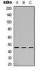 Arylsulfatase B antibody, LS-C354543, Lifespan Biosciences, Western Blot image 