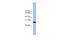 Chromosome 1 Open Reading Frame 216 antibody, A14772, Boster Biological Technology, Western Blot image 