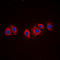 Platelet Derived Growth Factor Receptor Alpha antibody, LS-C352658, Lifespan Biosciences, Immunofluorescence image 