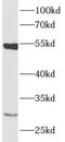 Adhesion Molecule With Ig Like Domain 3 antibody, FNab00361, FineTest, Western Blot image 