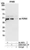 Purinergic Receptor P2X 5 antibody, A304-412A, Bethyl Labs, Immunoprecipitation image 