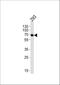 FYN Proto-Oncogene, Src Family Tyrosine Kinase antibody, M00684-2, Boster Biological Technology, Western Blot image 