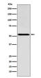 Thyroid Hormone Receptor Alpha antibody, M01775-1, Boster Biological Technology, Western Blot image 