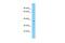 E3 ubiquitin-protein ligase MARCH5 antibody, ARP43232_P050, Aviva Systems Biology, Western Blot image 