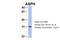 Aspartate Beta-Hydroxylase antibody, NBP1-69229, Novus Biologicals, Western Blot image 