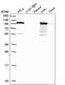 Aldehyde Dehydrogenase 1 Family Member L1 antibody, NBP2-55574, Novus Biologicals, Western Blot image 