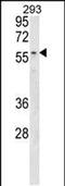 Membrane Bound O-Acyltransferase Domain Containing 2 antibody, PA5-48906, Invitrogen Antibodies, Western Blot image 