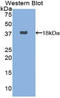 FASN antibody, LS-C293845, Lifespan Biosciences, Western Blot image 