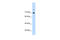 Interleukin Enhancer Binding Factor 3 antibody, 29-328, ProSci, Western Blot image 