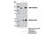 Actin Filament Associated Protein 1 Like 2 antibody, 12796S, Cell Signaling Technology, Immunoprecipitation image 