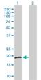 RB Binding Protein 9, Serine Hydrolase antibody, H00010741-D01F, Novus Biologicals, Western Blot image 