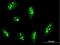 Ribosomal RNA Processing 12 Homolog antibody, H00023223-B01P, Novus Biologicals, Immunocytochemistry image 