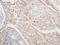BCL2 Associated Athanogene 3 antibody, NBP2-15543, Novus Biologicals, Immunohistochemistry paraffin image 