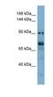 Cation Channel Sperm Associated Auxiliary Subunit Delta antibody, NBP1-91461, Novus Biologicals, Western Blot image 