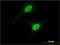 Calpain 3 antibody, H00000825-M01, Novus Biologicals, Immunocytochemistry image 