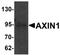 Axin 1 antibody, orb95542, Biorbyt, Western Blot image 