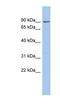 Nephrocystin 1 antibody, NBP1-59110, Novus Biologicals, Western Blot image 