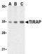 TIR Domain Containing Adaptor Protein antibody, GTX77618, GeneTex, Western Blot image 