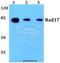 RAD17 Checkpoint Clamp Loader Component antibody, A02159-1, Boster Biological Technology, Western Blot image 