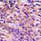 PEAK1 Related, Kinase-Activating Pseudokinase 1 antibody, orb215993, Biorbyt, Immunohistochemistry paraffin image 
