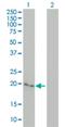 Cytoglobin antibody, H00114757-M02, Novus Biologicals, Western Blot image 