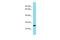 DIRAS Family GTPase 2 antibody, PA5-71083, Invitrogen Antibodies, Western Blot image 