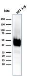 Keratin 8 antibody, GTX02668, GeneTex, Western Blot image 
