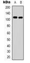 Ephrin type-A receptor 1 antibody, LS-C368826, Lifespan Biosciences, Western Blot image 