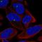 Zinc Finger Protein 766 antibody, PA5-66587, Invitrogen Antibodies, Immunofluorescence image 