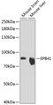 Erythrocyte Membrane Protein Band 4.1 antibody, 14-420, ProSci, Western Blot image 