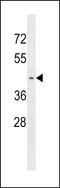 Paraneoplastic antigen-like protein 6A antibody, LS-C158689, Lifespan Biosciences, Western Blot image 