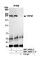 Transient Receptor Potential Cation Channel Subfamily M Member 7 antibody, NBP1-46829, Novus Biologicals, Western Blot image 