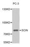 Scinderin antibody, MBS128884, MyBioSource, Western Blot image 