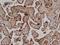 CD59 Molecule (CD59 Blood Group) antibody, NB100-65537, Novus Biologicals, Immunohistochemistry paraffin image 