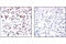 MRE11 Homolog, Double Strand Break Repair Nuclease antibody, 4895S, Cell Signaling Technology, Immunohistochemistry paraffin image 