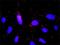 G Protein Subunit Beta 5 antibody, H00010681-M01, Novus Biologicals, Proximity Ligation Assay image 