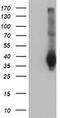 LRAT Domain Containing 2 antibody, MA5-25310, Invitrogen Antibodies, Western Blot image 