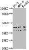 Rhomboid Domain Containing 3 antibody, CSB-PA27742A0Rb, Cusabio, Western Blot image 