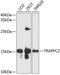 Trafficking Protein Particle Complex 2 antibody, A04968, Boster Biological Technology, Western Blot image 