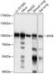Epidermal Growth Factor Receptor Pathway Substrate 8 antibody, 15-690, ProSci, Western Blot image 