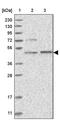 PTGES3L-AARSD1 Readthrough antibody, PA5-54871, Invitrogen Antibodies, Western Blot image 