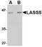Ceramide Synthase 5 antibody, LS-C83889, Lifespan Biosciences, Western Blot image 