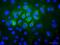 Keratin 7 antibody, ab9021, Abcam, Immunofluorescence image 