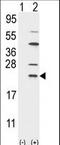 Ubiquitin Conjugating Enzyme E2 C antibody, LS-C160375, Lifespan Biosciences, Western Blot image 