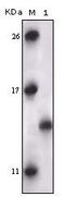 MAPK Activated Protein Kinase 5 antibody, MA5-15352, Invitrogen Antibodies, Western Blot image 