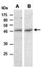Coactivator Associated Arginine Methyltransferase 1 antibody, orb67015, Biorbyt, Western Blot image 