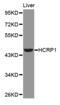 VPS37A Subunit Of ESCRT-I antibody, MBS127272, MyBioSource, Western Blot image 